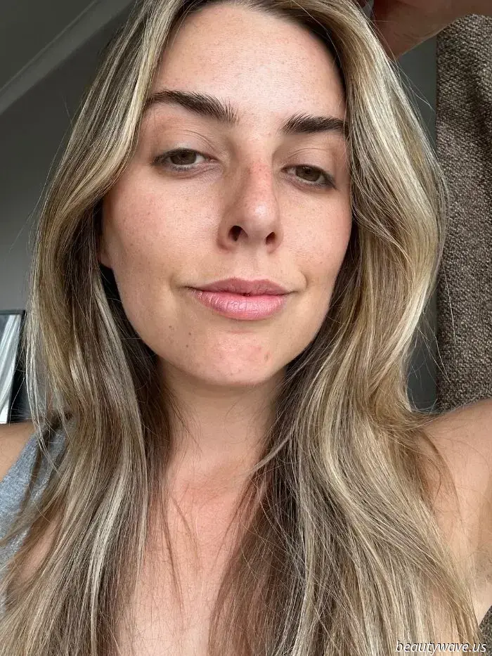 This £20 face serum competes with every injectable skin booster I have ever used.