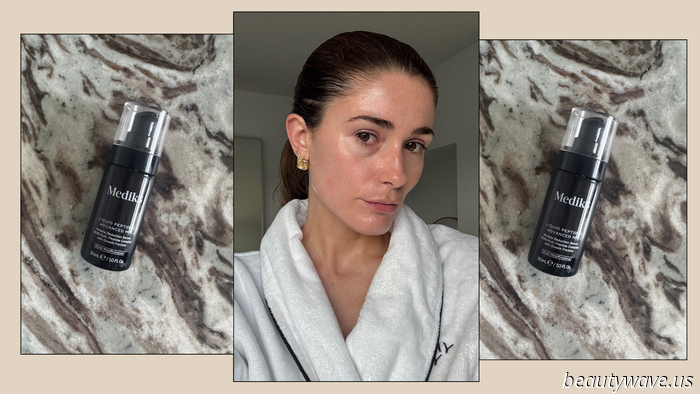 Ho appena posticipato il mio prossimo appuntamento per il Botox grazie a questo siero per il viso (in offerta)