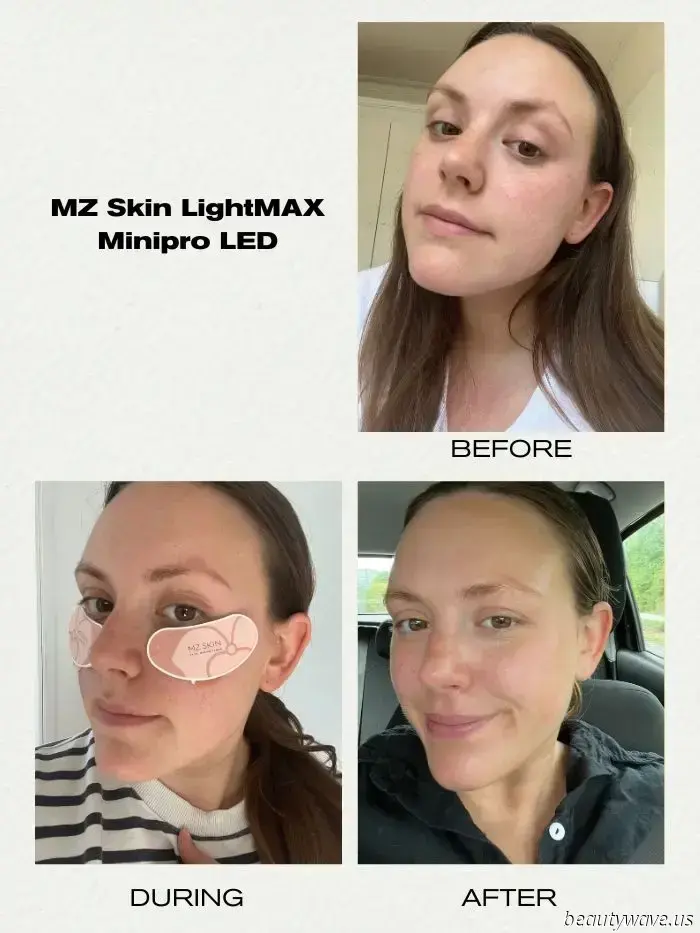 We're on a mission to eliminate our dark circles — these LED eye masks have revolutionized the process.
