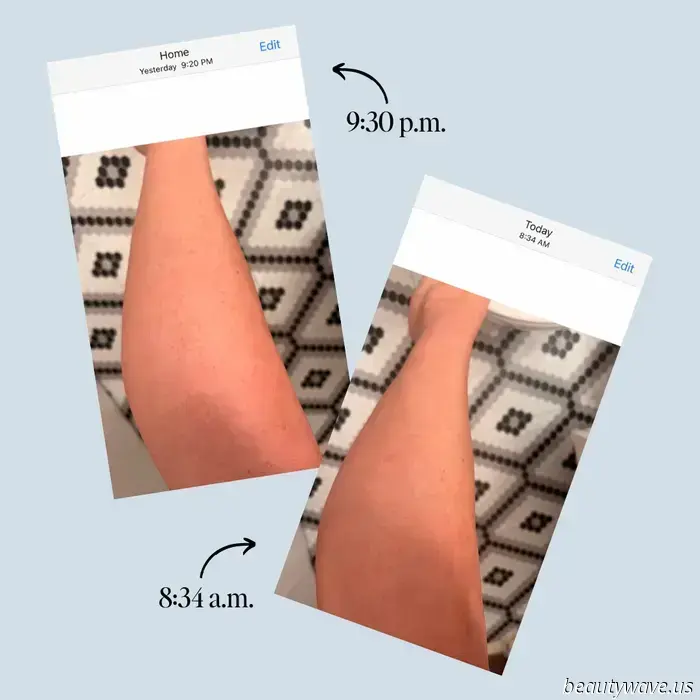 This Amazon product acts like a magic eraser for razor burn, and I captured photos to demonstrate its effectiveness.