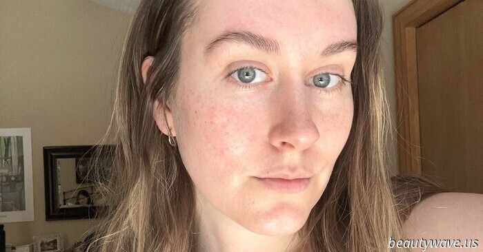 I Tested This At-Home Micro-Needling System—Now, My Go-To Concealers Are Gathering Dust.