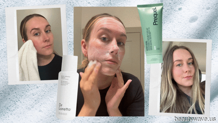 Ich habe 22 Gesichtsreiniger gegen Rosazea getestet&mdash;diese 8 von Dermatologen empfohlenen Optionen haben am besten abgeschnitten.