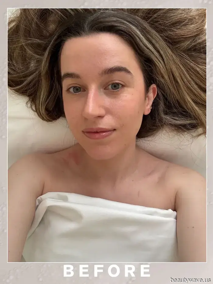 No, not Masseter Botox—this is my most closely guarded secret for dealing with teeth grinding.