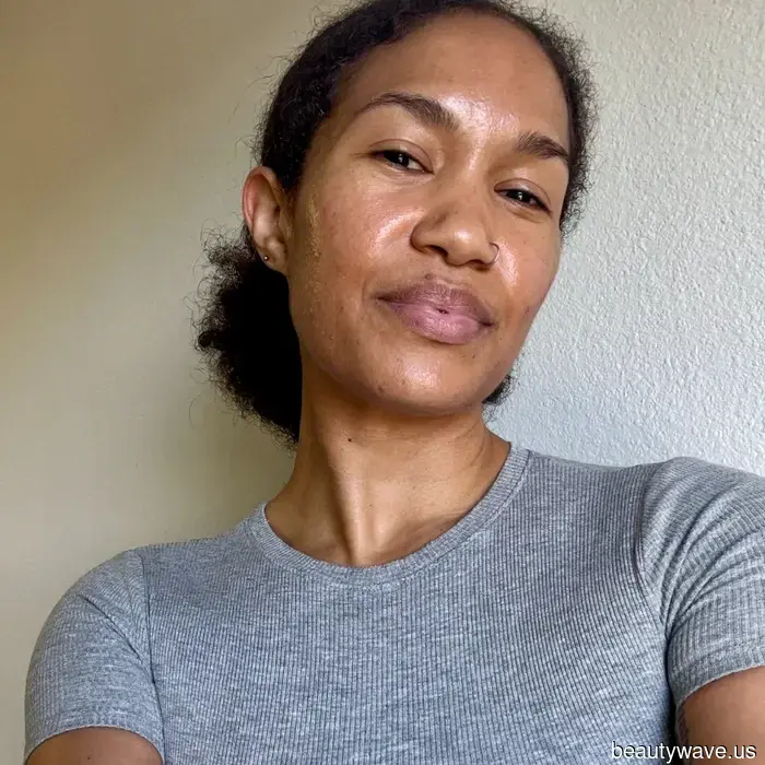 Ho provato molti trattamenti&mdash;questo è l'unico che ha davvero trasformato la mia pelle danneggiata e soggetta all'acne.