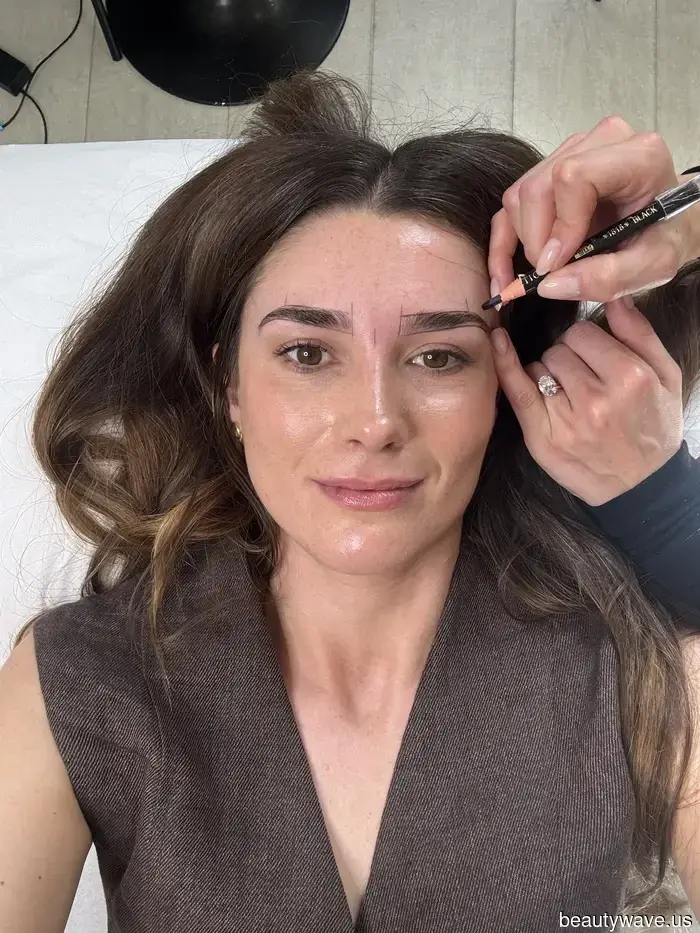 Not Botox, Not Lymphatic Drainage—This Brow Treatment Has Contoured My Face Like No Other.