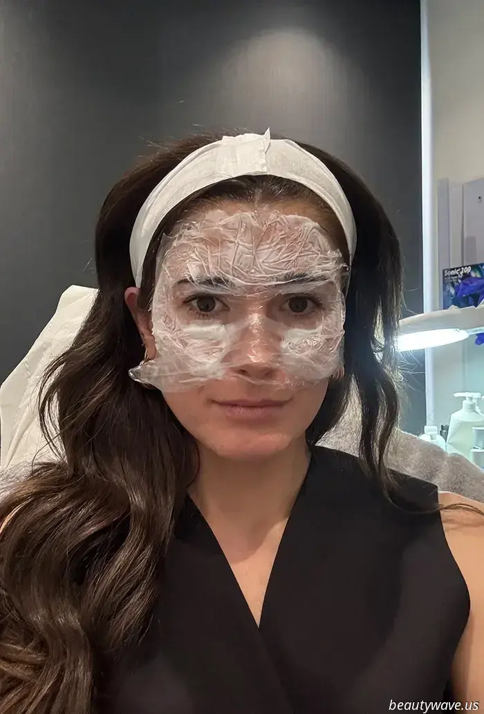 Ich habe die Hebe- und-formende Behandlung als Botox-Alternative ausprobiert – Das sind meine Ergebnisse nach 3 Monaten