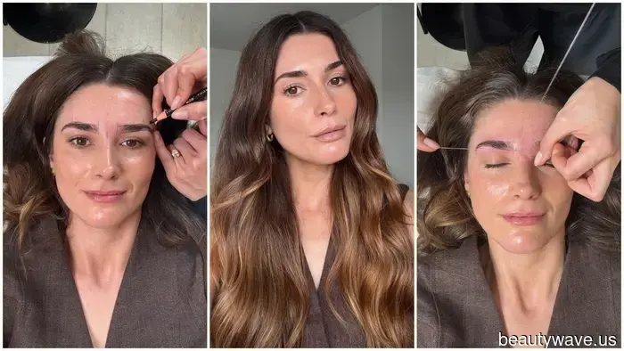 Not Botox, Not Lymphatic Drainage—This Brow Treatment Has Contoured My Face Like No Other.