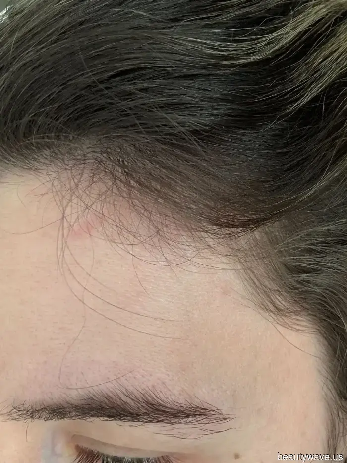 I’ve experimented with numerous products for fragile, damaged hair—this serum truly delivers results.