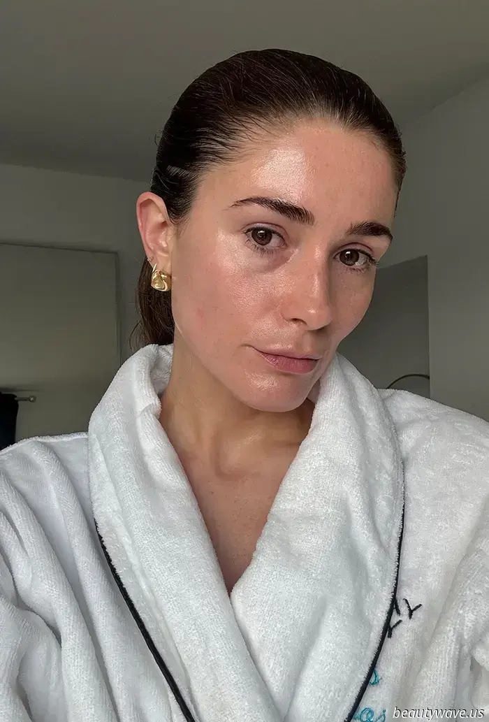 Dark Circles, Who? This Eye Cream Recommended by Derms Is the Most Remarkable Available