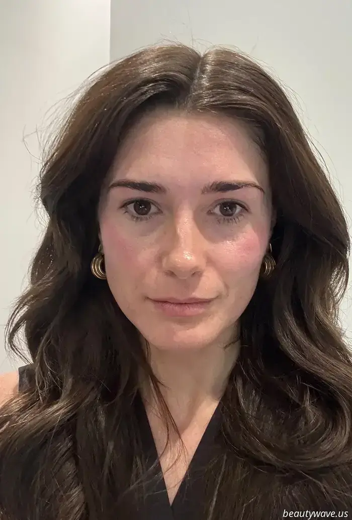 Ich habe die Hebe- und-formende Behandlung als Botox-Alternative ausprobiert – Das sind meine Ergebnisse nach 3 Monaten