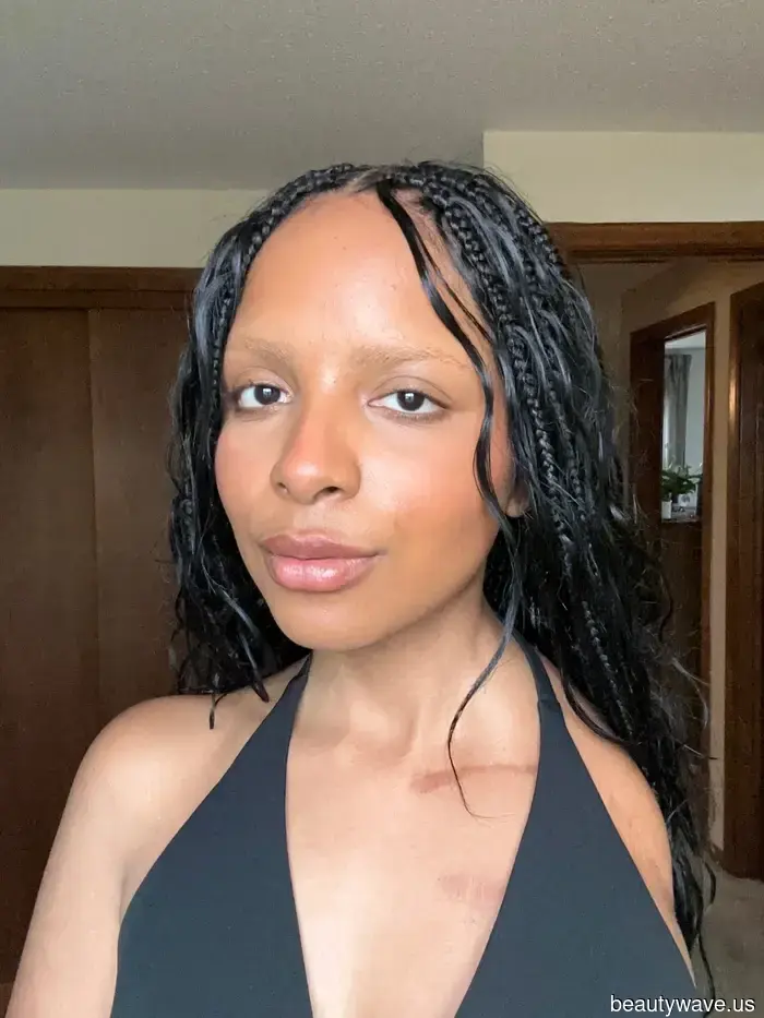 Accessible and Aspirational Beauty Represents the Future—a Model and Amputee Highlights the Brands That Are Getting It Right.