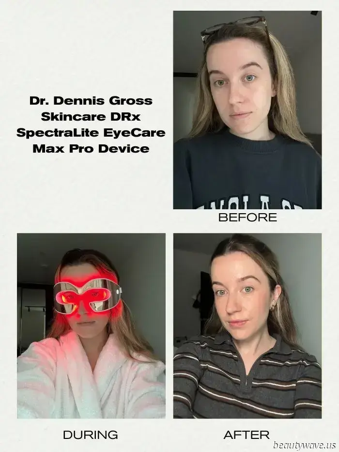 We're on a mission to eliminate our dark circles — these LED eye masks have revolutionized the process.