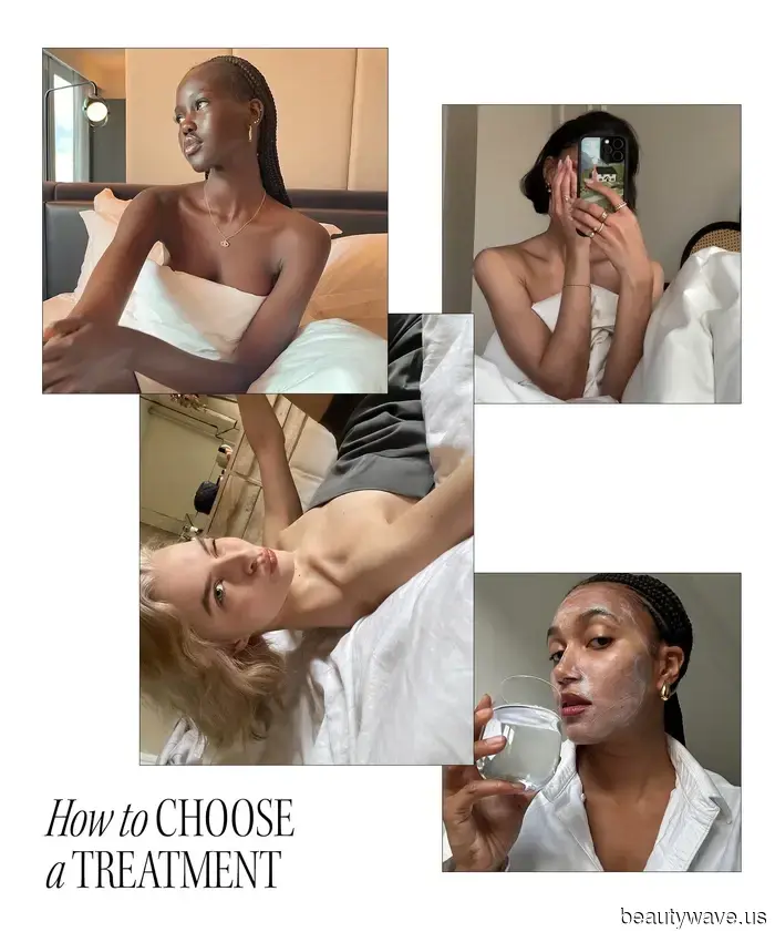 From Sofwave to Salmon Sperm: All the Pre-Wedding Skin Treatments to Be Aware of in 2025