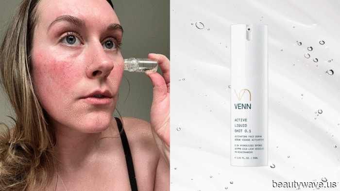 Most dermatologists do not advise DIY microneedling—fortunately, these three alternatives are equally effective.