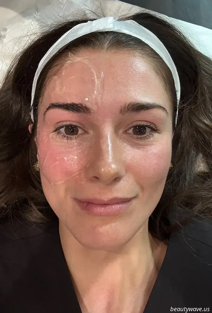 Ich habe die Hebe- und-formende Behandlung als Botox-Alternative ausprobiert – Das sind meine Ergebnisse nach 3 Monaten