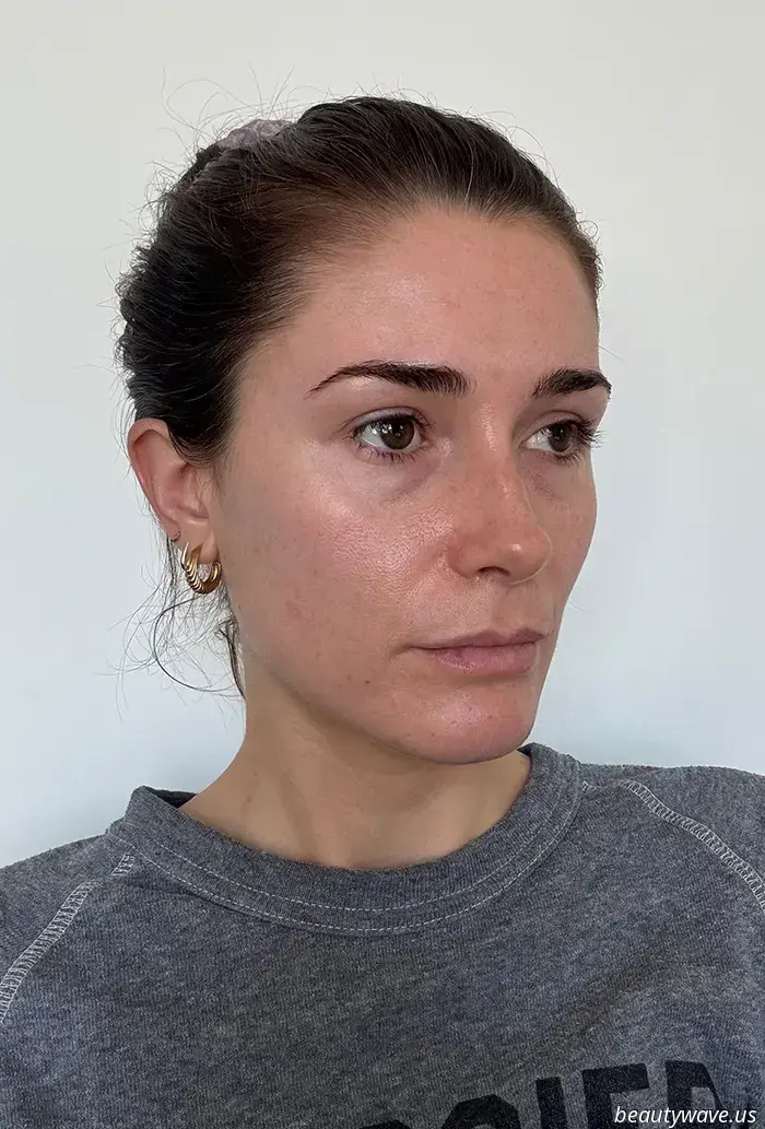 Dark Circles, Who? This Eye Cream Recommended by Derms Is the Most Remarkable Available