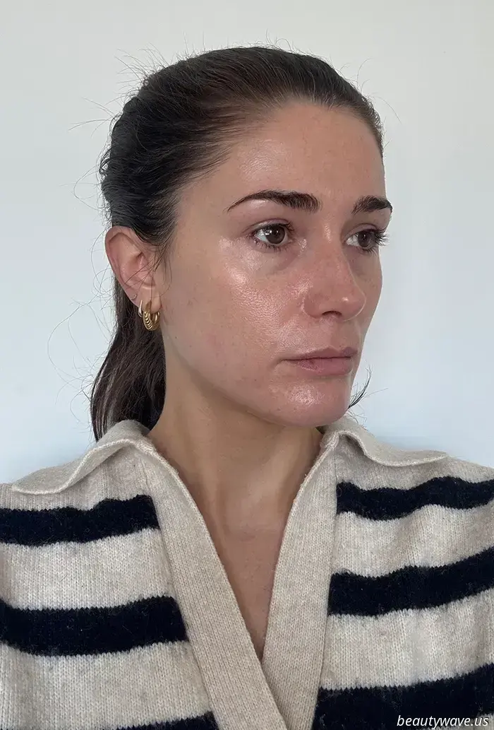 Dark Circles, Who? This Eye Cream Recommended by Derms Is the Most Remarkable Available