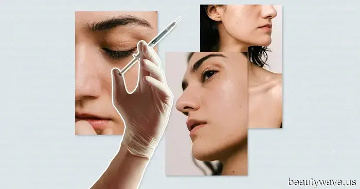 I Tested PRP for My Fatigued-Looking Under-Eyes—Here’s What Happened