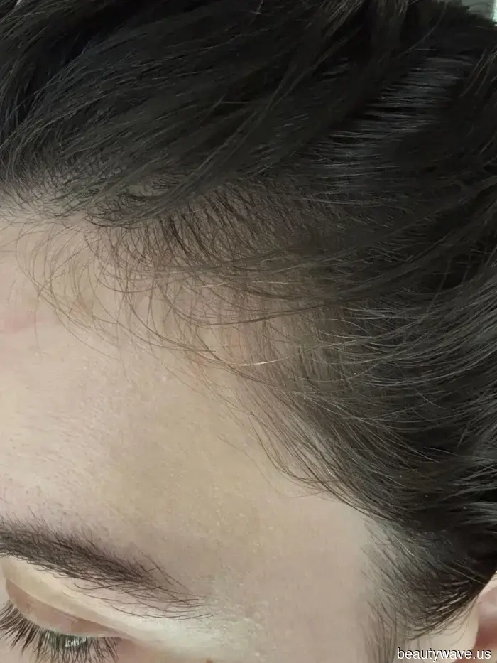 I’ve experimented with numerous products for fragile, damaged hair—this serum truly delivers results.