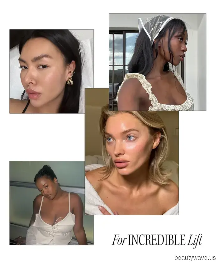 From Sofwave to Salmon Sperm: All the Pre-Wedding Skin Treatments to Be Aware of in 2025