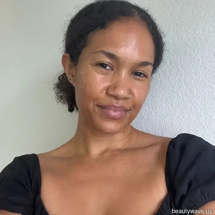 Tretinoin Harmed My Skin Barrier—Sabrina Carpenter's Aesthetician Provided These Tips for Better Complexion