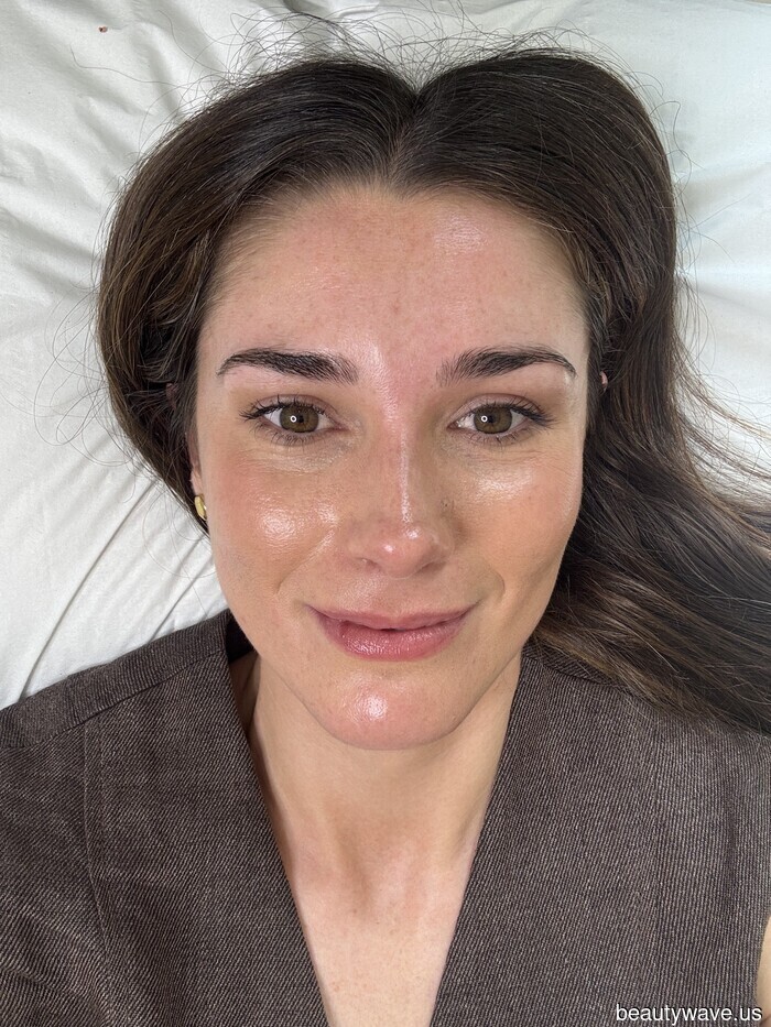 Not Botox, Not Lymphatic Drainage—This Brow Treatment Has Contoured My Face Like No Other.