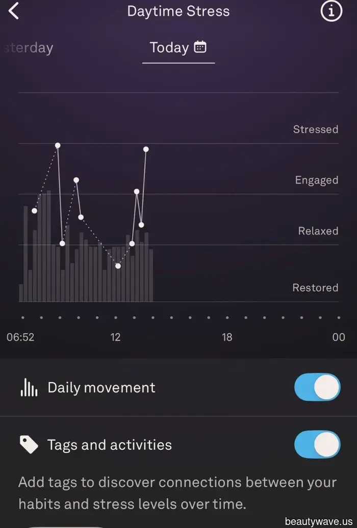 I've Worn the Oura Ring for 3 Months—Here’s What You Need to Consider Before Purchasing One