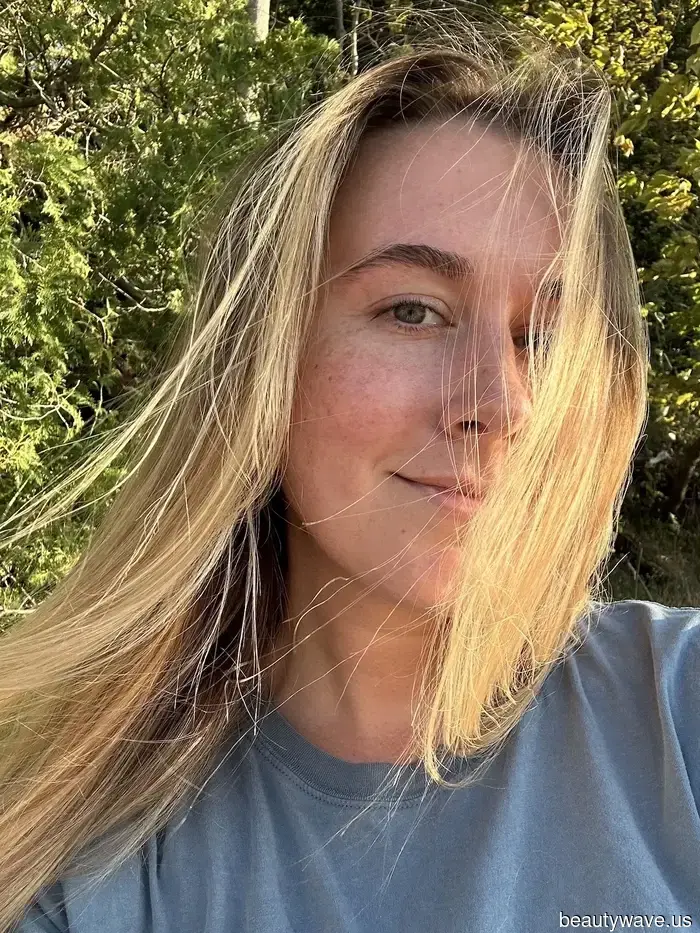 I Have Rosacea—These Sunscreens, Recommended by Experts, Are the Only Ones I Rely On to Calm Persistent Redness.
