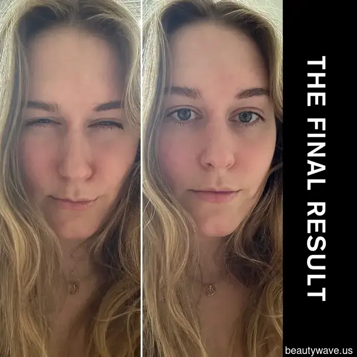 I'm Utilizing Copper Peptides to Boost the Effects of My Botox—Here’s the Reason.