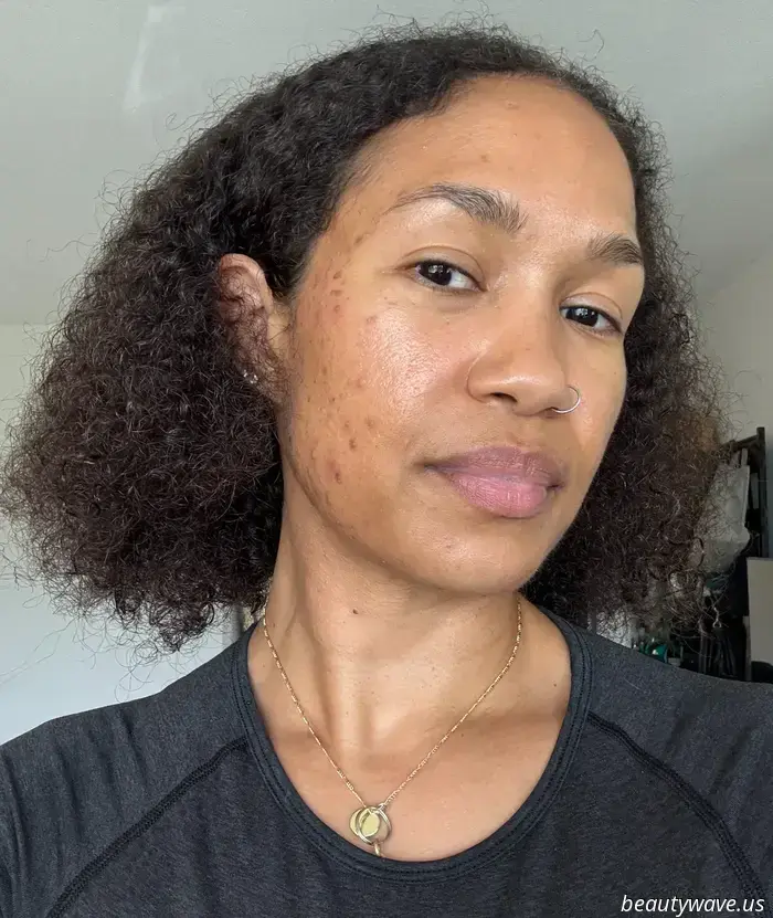 Retinol irritates my sensitive, acne-prone skin, so I opted for this surprisingly effective alternative instead.
